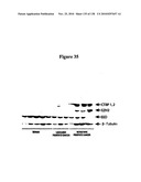 EXPRESSION PROFILE OF PROSTATE CANCER diagram and image