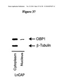 EXPRESSION PROFILE OF PROSTATE CANCER diagram and image