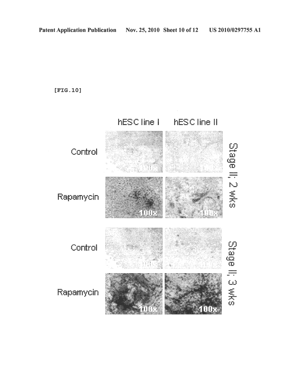  Method for Differentiating of Human Embryonic Stem Cells Into the Osteoblastic Lineage - diagram, schematic, and image 11