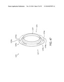 COAXIAL CABLE CONNECTOR HAVING ELECTRICAL CONTINUITY MEMBER diagram and image