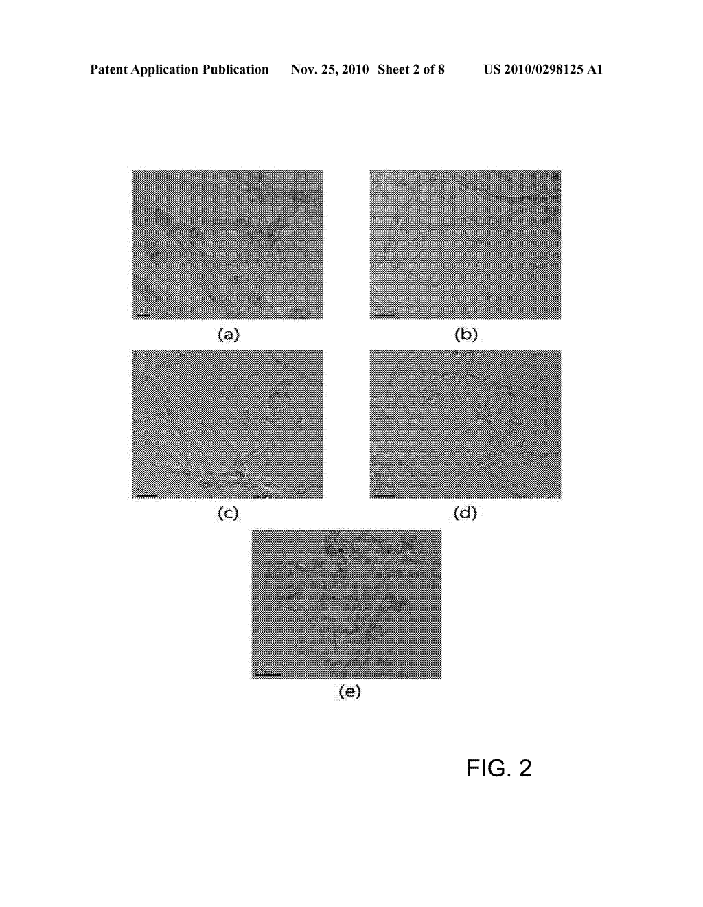 CARBON NANOTUBE CATALYSTS HAVING METAL CATALYST NANO-PARTICLES SUPPORTED ON INNER CHANNEL OF CARBON NANOTUBE AND PREPARATION METHOD THEREOF - diagram, schematic, and image 03