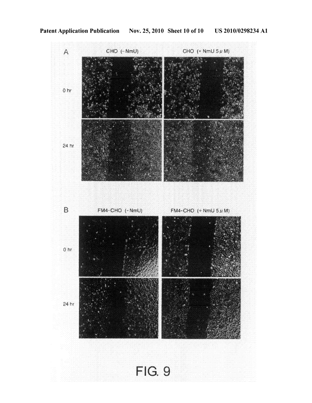 Cancer therapeutic agents comprising a ligand for the neuromedin u receptor 2 (fm4) molecule as an active ingredient - diagram, schematic, and image 11