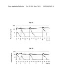 Continuous Administration of Dopa Decarboxylase Inhibitors and Compositions for Same diagram and image