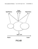 Method of improving cognitive functions in individuals with down syndrome and/or alzheimer s disease diagram and image