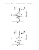 Method of improving cognitive functions in individuals with down syndrome and/or alzheimer s disease diagram and image