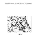 EphA2 AGONISTIC MONOCLONAL ANTIBODIES AND METHODS OF USE THEREOF diagram and image