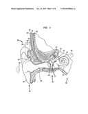 BONE CONDUCTION DEVICE HAVING A MULTILAYER PIEZOELECTRIC ELEMENT diagram and image