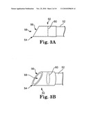 PELVIC FLOOR TREATMENTS AND RELATED TOOLS AND IMPLANTS diagram and image