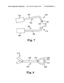 PELVIC FLOOR TREATMENTS AND RELATED TOOLS AND IMPLANTS diagram and image