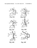 PELVIC FLOOR TREATMENTS AND RELATED TOOLS AND IMPLANTS diagram and image