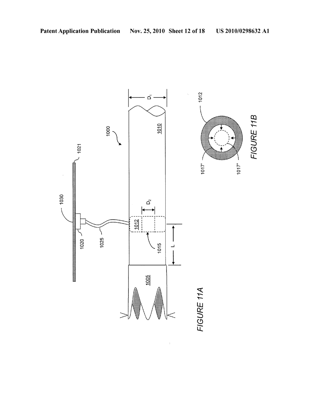 Resistive Anti-Obesity Devices - diagram, schematic, and image 13