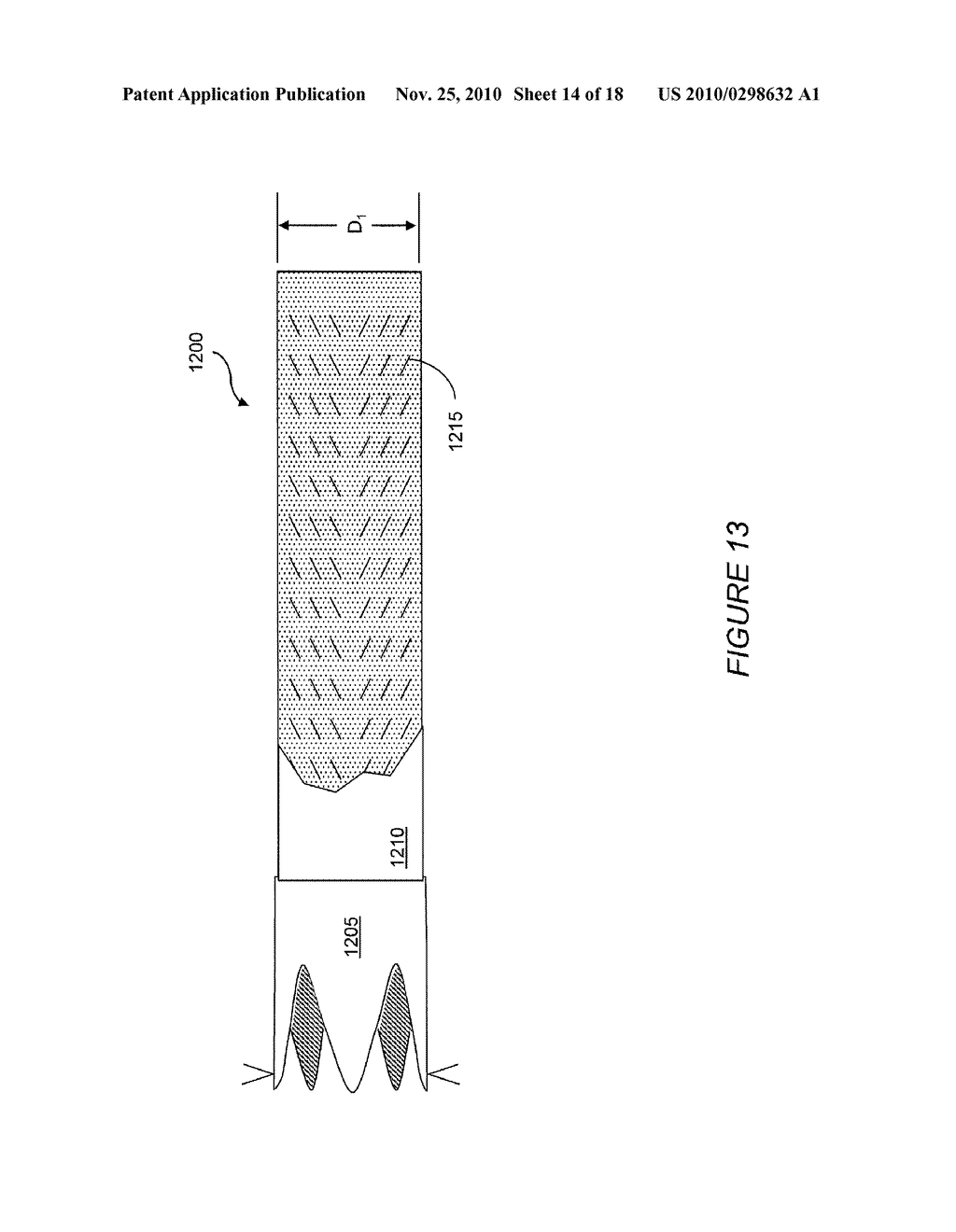 Resistive Anti-Obesity Devices - diagram, schematic, and image 15