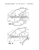 METHODS FOR USING SELF-RETAINING SUTURES IN ENDOSCOPIC PROCEDURES diagram and image