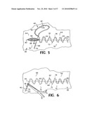 METHODS FOR USING SELF-RETAINING SUTURES IN ENDOSCOPIC PROCEDURES diagram and image