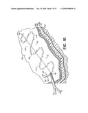 METHODS FOR USING SELF-RETAINING SUTURES IN ENDOSCOPIC PROCEDURES diagram and image