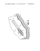 METHODS FOR USING SELF-RETAINING SUTURES IN ENDOSCOPIC PROCEDURES diagram and image