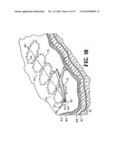 METHODS FOR USING SELF-RETAINING SUTURES IN ENDOSCOPIC PROCEDURES diagram and image