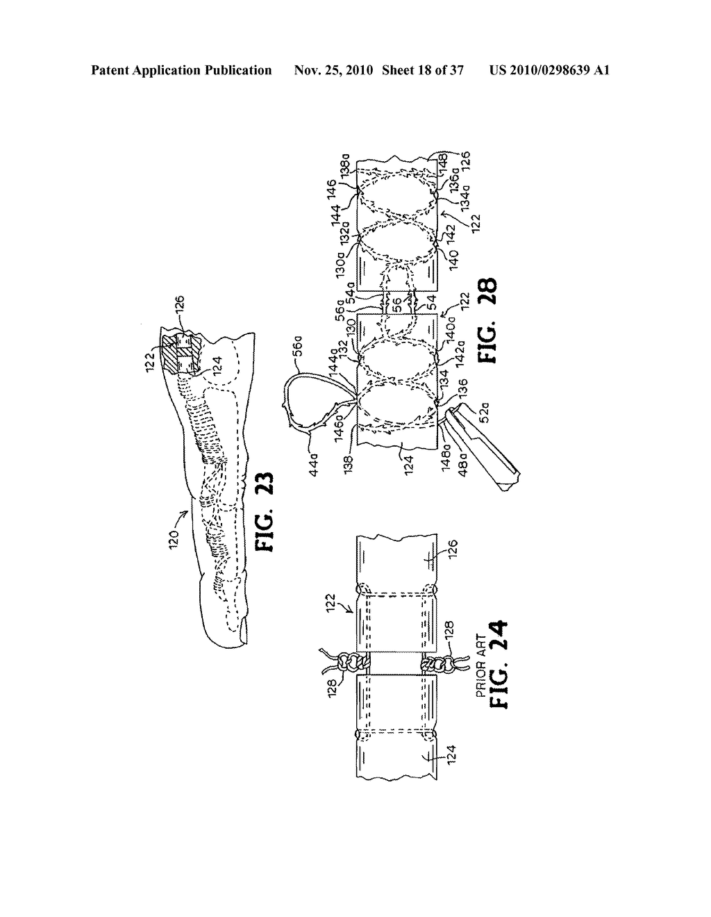 METHODS FOR USING SELF-RETAINING SUTURES IN ENDOSCOPIC PROCEDURES - diagram, schematic, and image 19