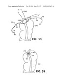 METHODS FOR USING SELF-RETAINING SUTURES IN ENDOSCOPIC PROCEDURES diagram and image