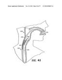 METHODS FOR USING SELF-RETAINING SUTURES IN ENDOSCOPIC PROCEDURES diagram and image