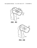 METHODS FOR USING SELF-RETAINING SUTURES IN ENDOSCOPIC PROCEDURES diagram and image