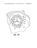 METHODS FOR USING SELF-RETAINING SUTURES IN ENDOSCOPIC PROCEDURES diagram and image