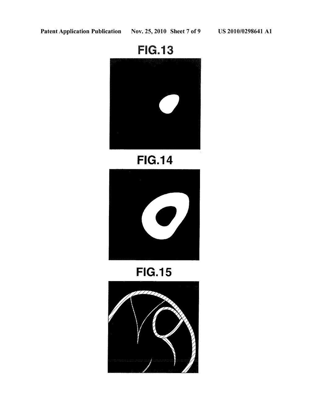 ENDOSCOPE SYSTEM - diagram, schematic, and image 08