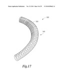 MANIPULATABLE GUIDE SYSTEM AND METHODS FOR NATURAL ORIFICE TRANSLUMENAL ENDOSCOPIC SURGERY diagram and image