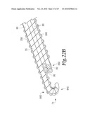 MANIPULATABLE GUIDE SYSTEM AND METHODS FOR NATURAL ORIFICE TRANSLUMENAL ENDOSCOPIC SURGERY diagram and image