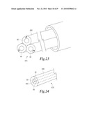 MANIPULATABLE GUIDE SYSTEM AND METHODS FOR NATURAL ORIFICE TRANSLUMENAL ENDOSCOPIC SURGERY diagram and image