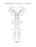 MANIPULATABLE GUIDE SYSTEM AND METHODS FOR NATURAL ORIFICE TRANSLUMENAL ENDOSCOPIC SURGERY diagram and image