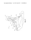 MANIPULATABLE GUIDE SYSTEM AND METHODS FOR NATURAL ORIFICE TRANSLUMENAL ENDOSCOPIC SURGERY diagram and image