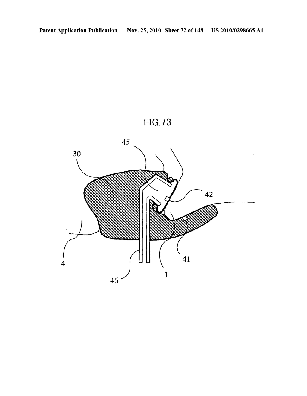 LIVING BODY INFORMATION DETECTION APPARATUS AND BLOOD-PRESSURE METER - diagram, schematic, and image 73