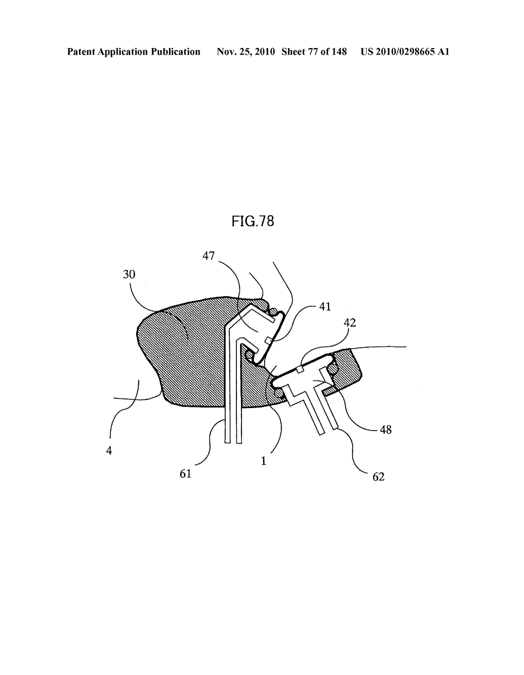 LIVING BODY INFORMATION DETECTION APPARATUS AND BLOOD-PRESSURE METER - diagram, schematic, and image 78