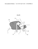 LIVING BODY INFORMATION DETECTION APPARATUS AND BLOOD-PRESSURE METER diagram and image