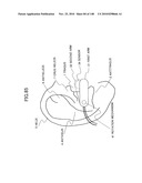 LIVING BODY INFORMATION DETECTION APPARATUS AND BLOOD-PRESSURE METER diagram and image