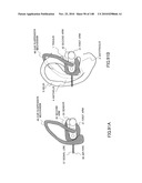 LIVING BODY INFORMATION DETECTION APPARATUS AND BLOOD-PRESSURE METER diagram and image