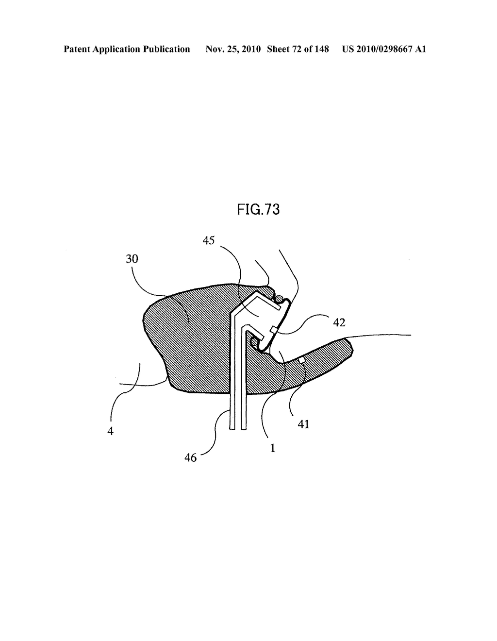 LIVING BODY INFORMATION DETECTION APPARATUS AND BLOOD-PRESSURE METER - diagram, schematic, and image 73