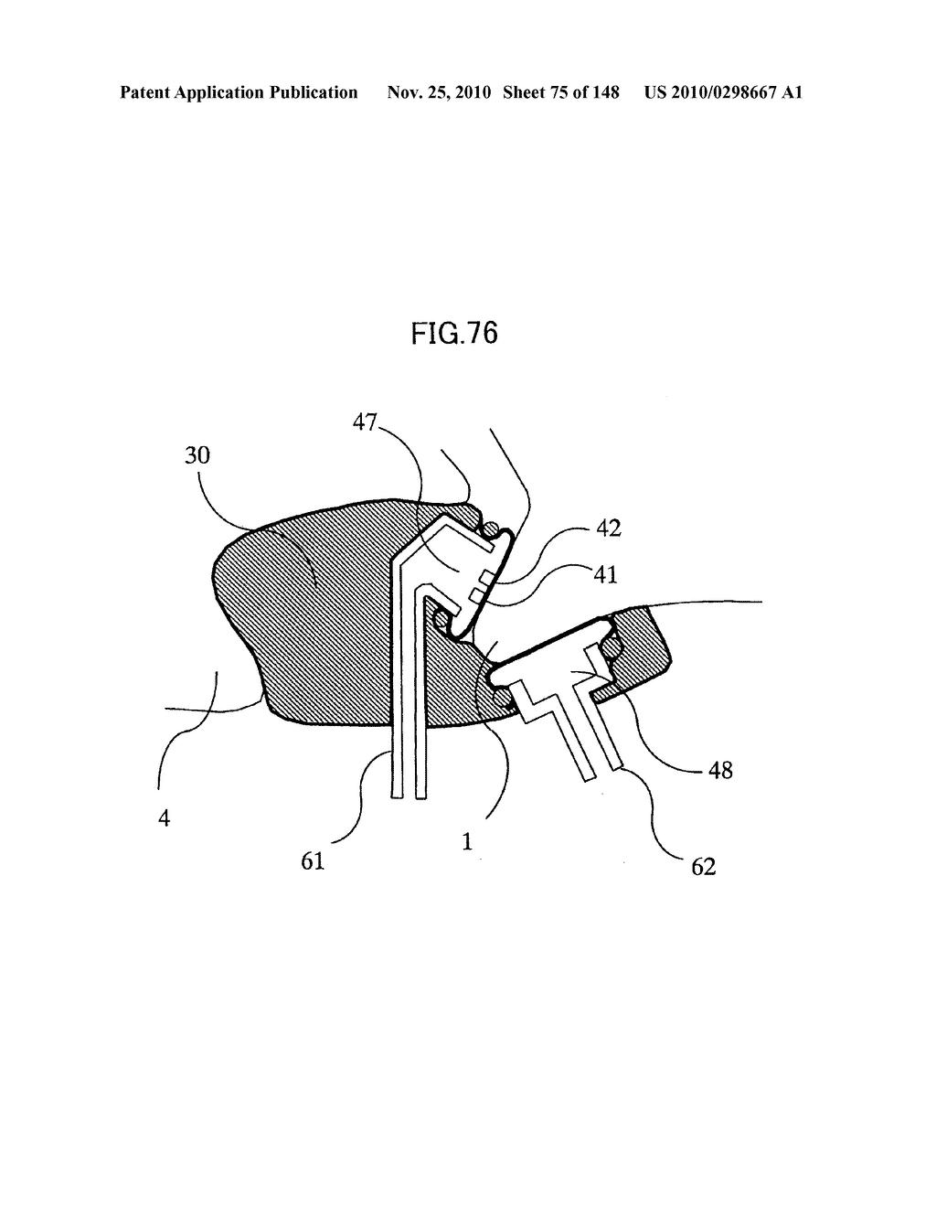 LIVING BODY INFORMATION DETECTION APPARATUS AND BLOOD-PRESSURE METER - diagram, schematic, and image 76