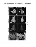 STROKE RISK ASSESSMENT diagram and image