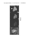 STROKE RISK ASSESSMENT diagram and image