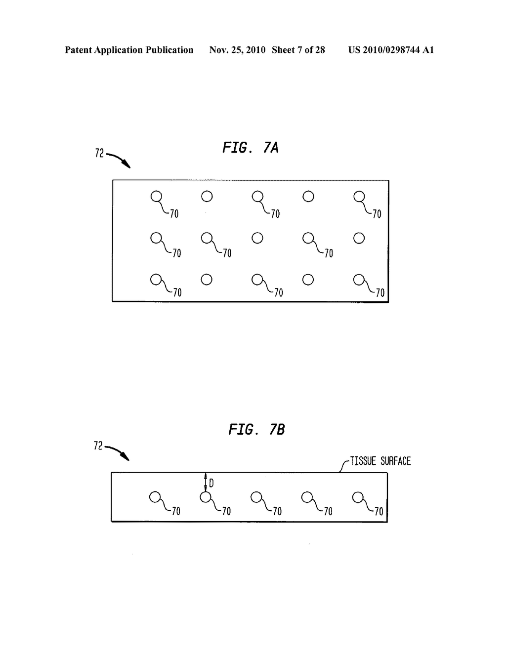 SYSTEM AND METHOD OF TREATING TISSUE WITH ULTRASOUND ENERGY - diagram, schematic, and image 08