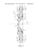 DEVICES, SYSTEMS, AND METHODS TO TREAT HEART FAILURE HAVING AN IMPROVED FLOW-CONTROL MECHANISM diagram and image