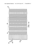 DEVICES, SYSTEMS, AND METHODS TO TREAT HEART FAILURE HAVING AN IMPROVED FLOW-CONTROL MECHANISM diagram and image