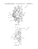 DEVICES, SYSTEMS, AND METHODS TO TREAT HEART FAILURE HAVING AN IMPROVED FLOW-CONTROL MECHANISM diagram and image