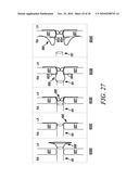 DEVICES, SYSTEMS, AND METHODS TO TREAT HEART FAILURE HAVING AN IMPROVED FLOW-CONTROL MECHANISM diagram and image