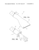 CLOSED SYSTEM FOR SURGICAL LIMB PREP diagram and image