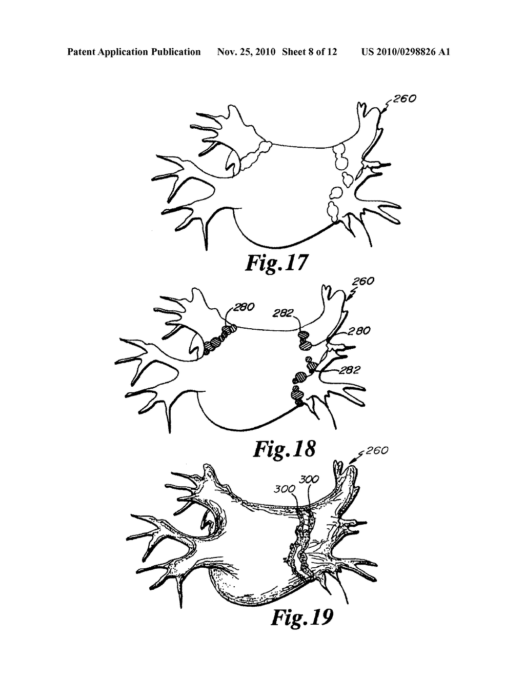 METHOD AND APPARATUS FOR CONTROLLING LESION SIZE IN CATHETER-BASED ABLATION TREATMENT - diagram, schematic, and image 09