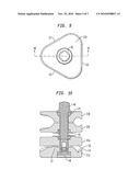 FIXATION CLAMP diagram and image