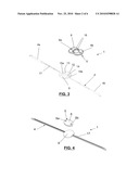  FIXATION DEVICE FOR THE FIXATION OF BONE FRAGMENTS diagram and image